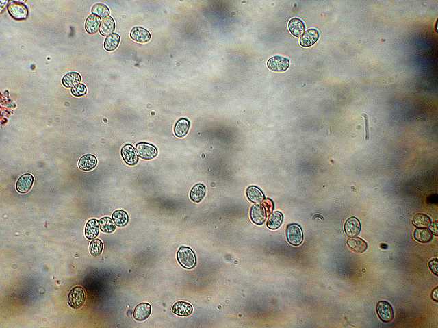 Pluteus   pseudorobertii   M.M. Moser